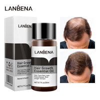 الزنجبيل منتجات نمو الشعر سريع النمو الشعر من الضروري النفط مكافحة فقدان الشعر العلاج جعد التالفة مغذية تليين فروة الرأس الرعاية - الصورة 5